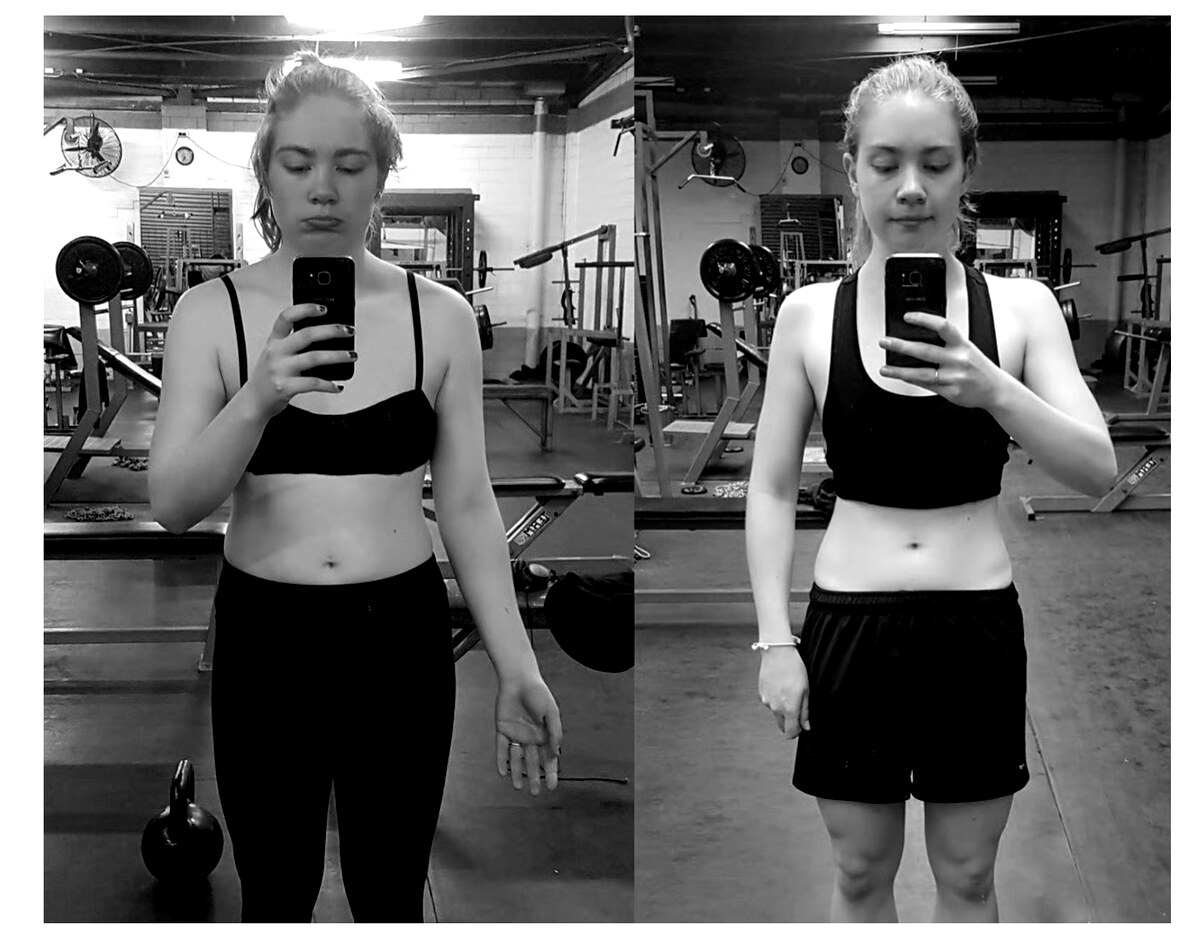 Emma — before and after transformation at Body Matrix
